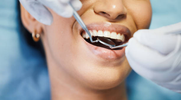 Best Emergency Dentist for Knocked-Out Tooth in Southwest Ranches, FL